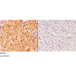 Anti-14-3-3 ζ (A79) Antibody from Bioworld Technology (BS2385) - Antibodies.com