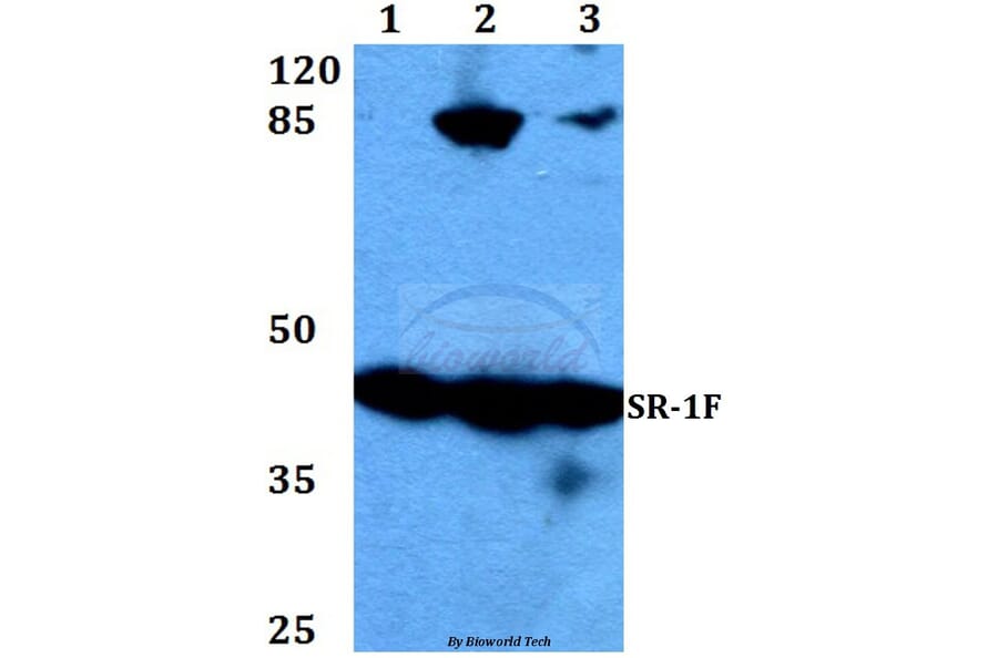 Anti-SR-1F (T126) Antibody from Bioworld Technology (BS2387) - Antibodies.com