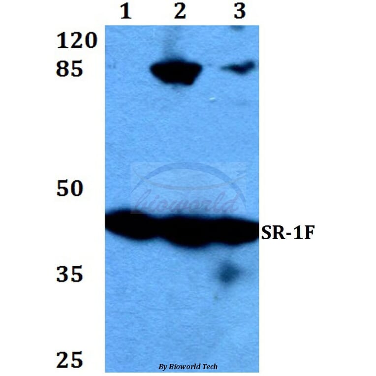 Anti-SR-1F (T126) Antibody from Bioworld Technology (BS2387) - Antibodies.com
