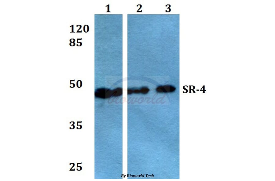 Anti-SR-4 (D47) Antibody from Bioworld Technology (BS2390) - Antibodies.com