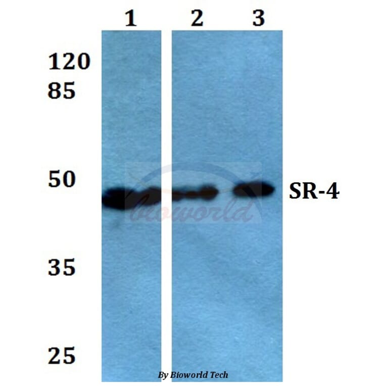 Anti-SR-4 (D47) Antibody from Bioworld Technology (BS2390) - Antibodies.com