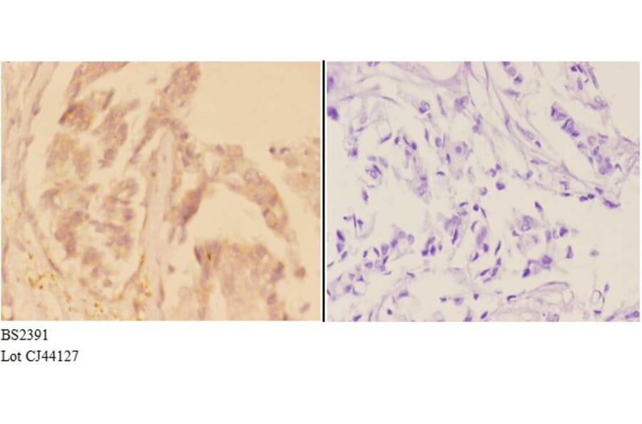 Anti-ADCY 1 (D252) Antibody from Bioworld Technology (BS2391) - Antibodies.com