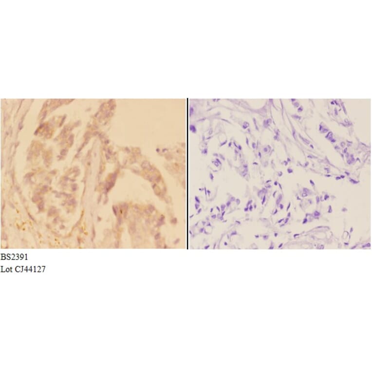 Anti-ADCY 1 (D252) Antibody from Bioworld Technology (BS2391) - Antibodies.com