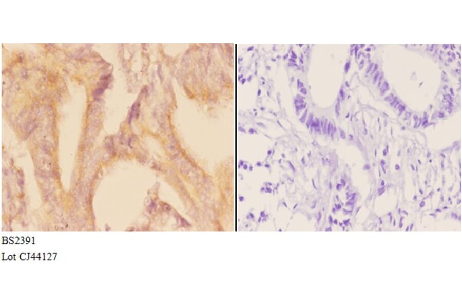 Anti-ADCY 1 (D252) Antibody from Bioworld Technology (BS2391) - Antibodies.com