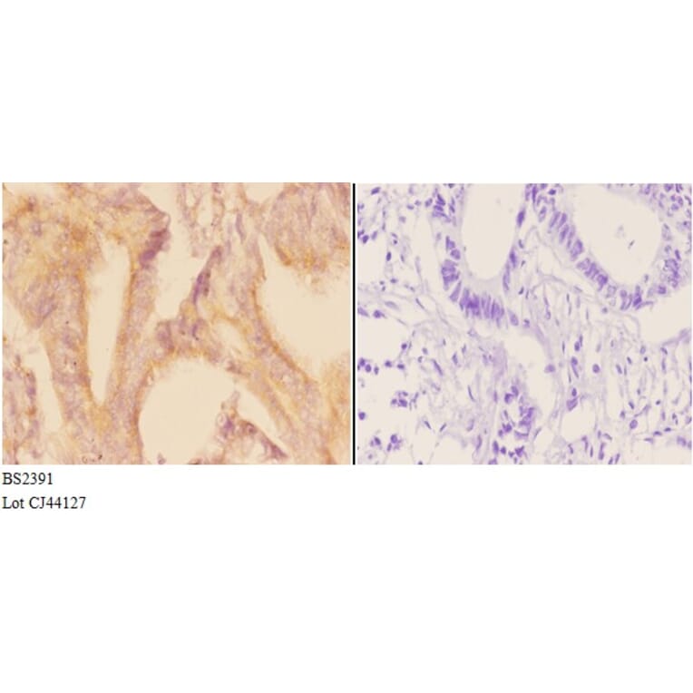 Anti-ADCY 1 (D252) Antibody from Bioworld Technology (BS2391) - Antibodies.com