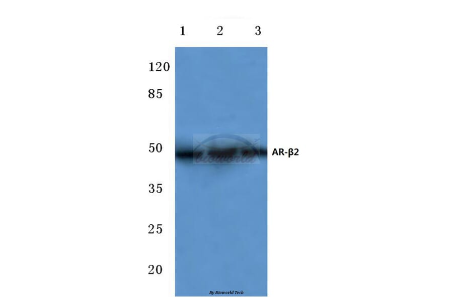 Anti-AR-β2 (R228) Antibody from Bioworld Technology (BS2392) - Antibodies.com