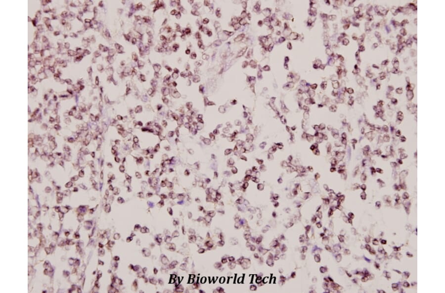 Anti-AR-β2 (R228) Antibody from Bioworld Technology (BS2392) - Antibodies.com
