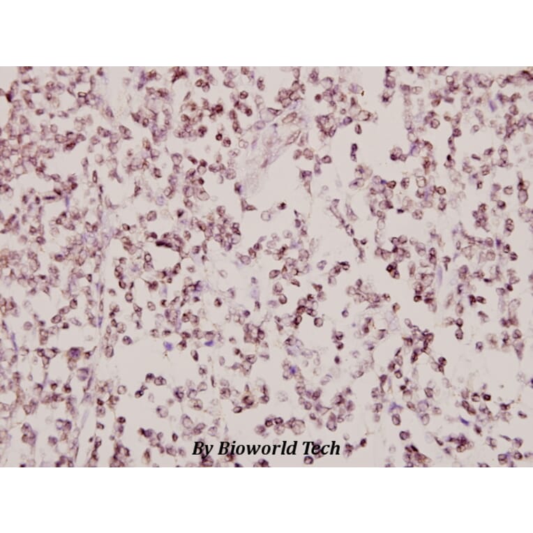 Anti-AR-β2 (R228) Antibody from Bioworld Technology (BS2392) - Antibodies.com