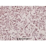 Anti-AR-β2 (R228) Antibody from Bioworld Technology (BS2392) - Antibodies.com
