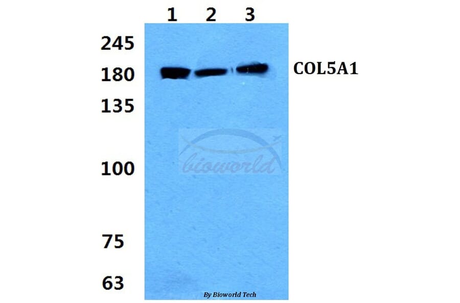 Anti-COL5A1 (E325) Antibody from Bioworld Technology (BS2400) - Antibodies.com
