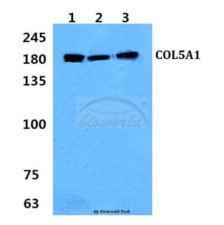 Anti-COL5A1 (E325) Antibody from Bioworld Technology (BS2400) - Antibodies.com