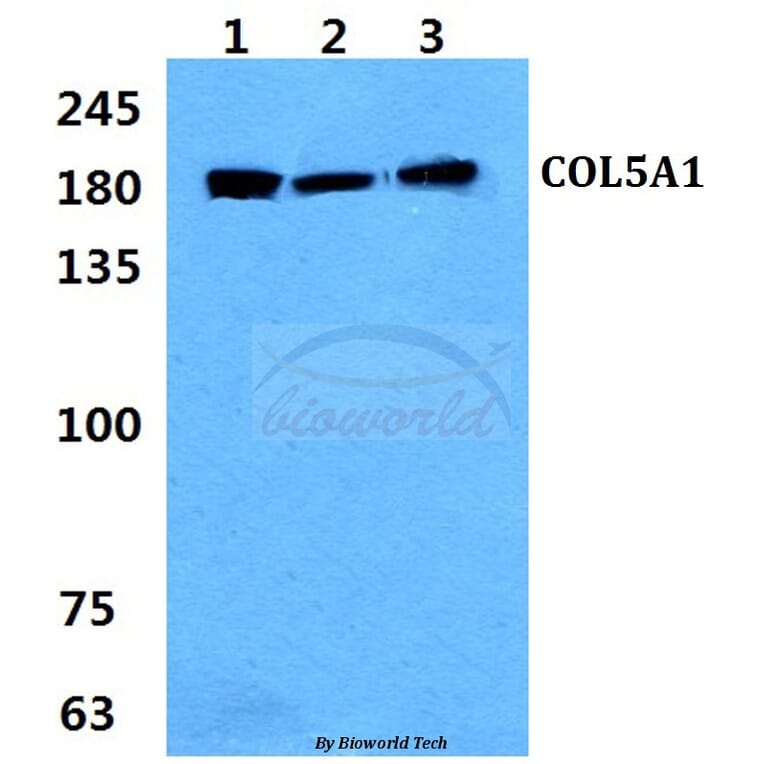 Anti-COL5A1 (E325) Antibody from Bioworld Technology (BS2400) - Antibodies.com