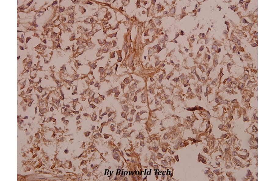 Anti-COL5A1 (E325) Antibody from Bioworld Technology (BS2400) - Antibodies.com