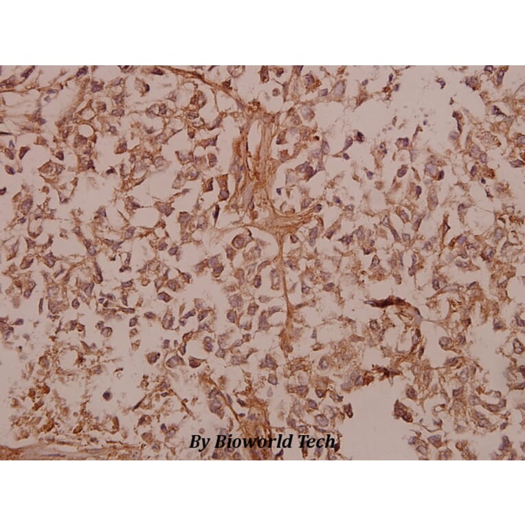 Anti-COL5A1 (E325) Antibody from Bioworld Technology (BS2400) - Antibodies.com