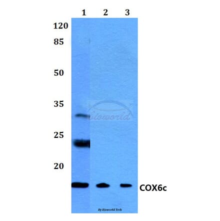 Anti-COX6c (R40) Antibody from Bioworld Technology (BS2402) - Antibodies.com