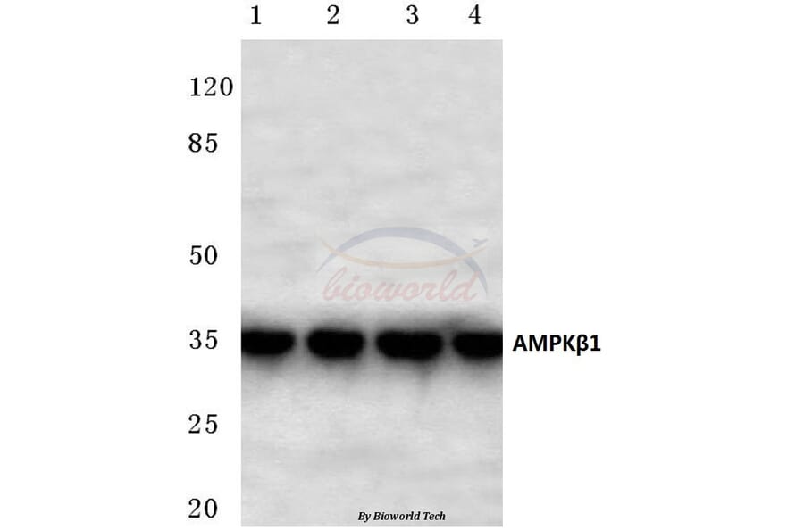 Anti-AMPKβ1 (H17) Antibody from Bioworld Technology (BS2406) - Antibodies.com