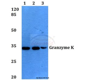 Anti-Granzyme K (H85) Antibody from Bioworld Technology (BS2413) - Antibodies.com