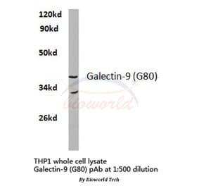 Anti-Galectin-9 (G80) Antibody from Bioworld Technology (BS2417) - Antibodies.com