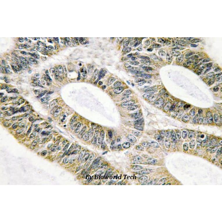 Anti-Galectin-9 (G80) Antibody from Bioworld Technology (BS2417) - Antibodies.com