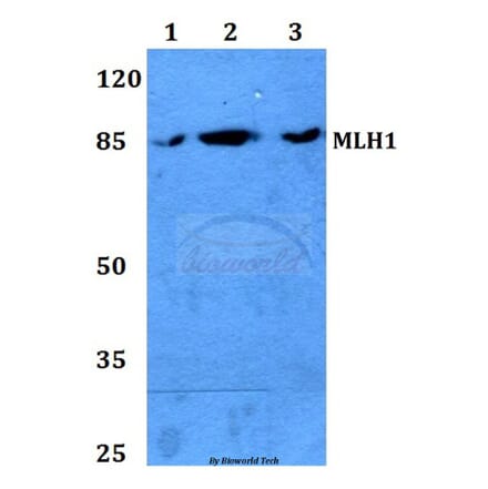 Anti-MLH1 (S467) Antibody from Bioworld Technology (BS2418) - Antibodies.com