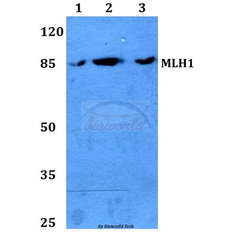 Anti-MLH1 (S467) Antibody from Bioworld Technology (BS2418) - Antibodies.com