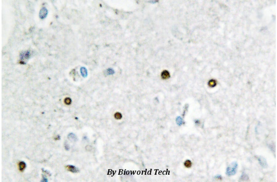 Anti-MSH6 / GTBP (E371) Antibody from Bioworld Technology (BS2420) - Antibodies.com