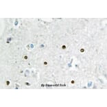 Anti-MSH6 / GTBP (E371) Antibody from Bioworld Technology (BS2420) - Antibodies.com