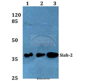Anti-Siah-2 (E266) Antibody from Bioworld Technology (BS2425) - Antibodies.com