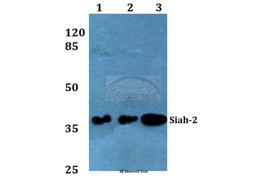 Anti-Siah-2 (E266) Antibody from Bioworld Technology (BS2425) - Antibodies.com
