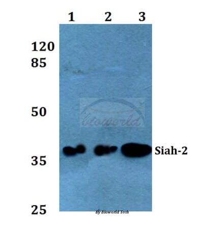 Anti-Siah-2 (E266) Antibody from Bioworld Technology (BS2425) - Antibodies.com