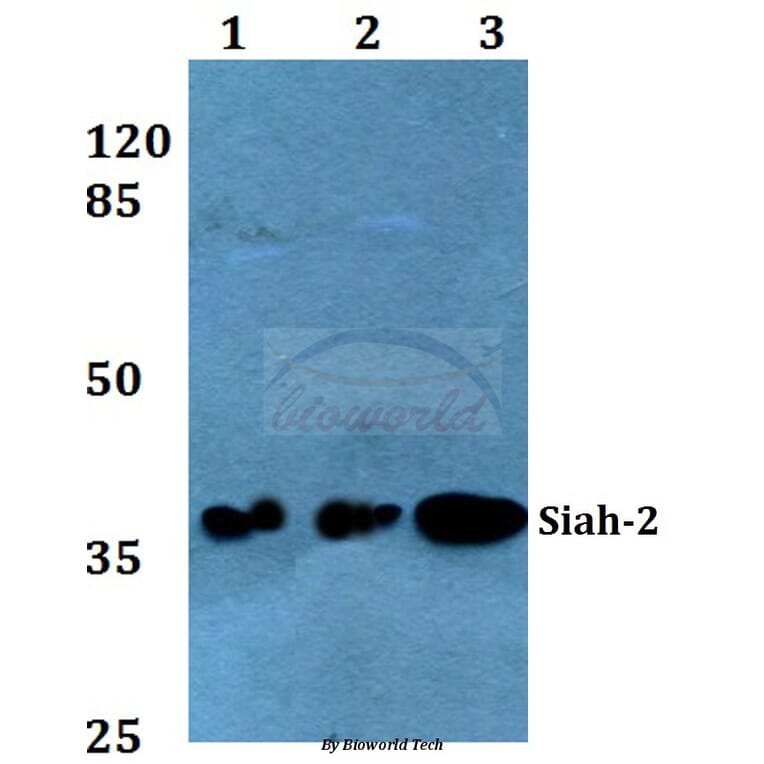 Anti-Siah-2 (E266) Antibody from Bioworld Technology (BS2425) - Antibodies.com