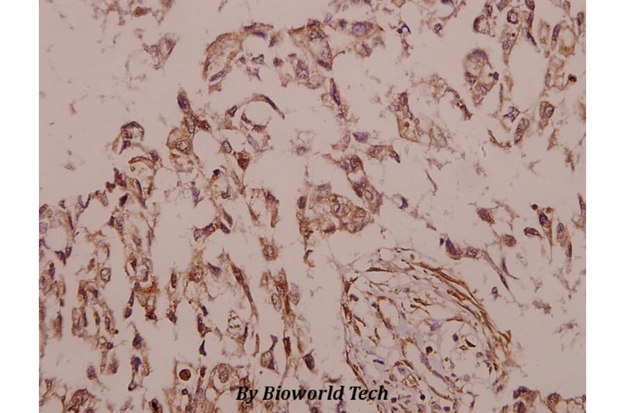 Anti-Siah-2 (E266) Antibody from Bioworld Technology (BS2425) - Antibodies.com