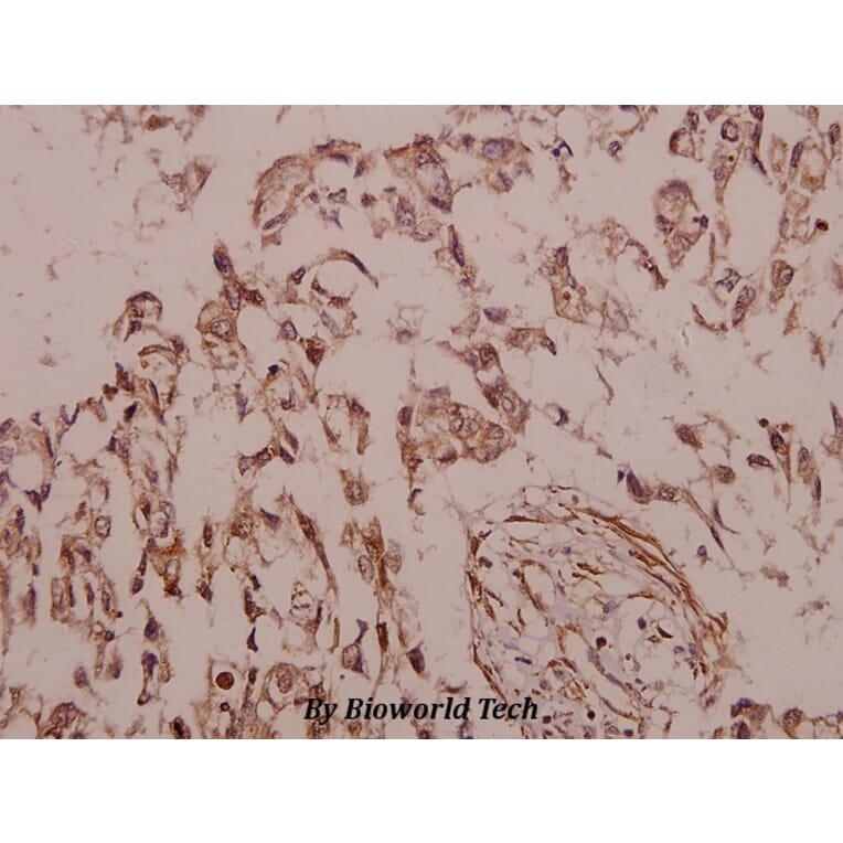 Anti-Siah-2 (E266) Antibody from Bioworld Technology (BS2425) - Antibodies.com