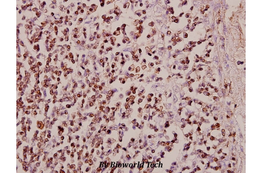Anti-Stat5 (W287) Antibody from Bioworld Technology (BS2427) - Antibodies.com
