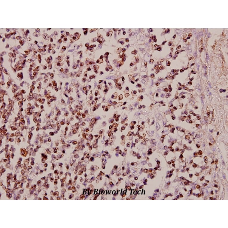 Anti-Stat5 (W287) Antibody from Bioworld Technology (BS2427) - Antibodies.com