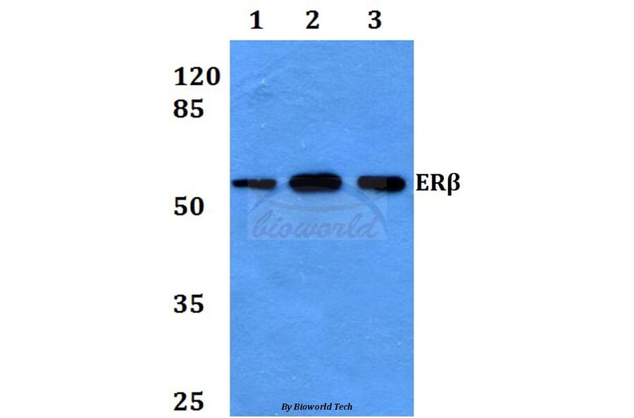 Anti-ERβ (E101) Antibody from Bioworld Technology (BS2429) - Antibodies.com