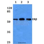 Anti-ERβ (E101) Antibody from Bioworld Technology (BS2429) - Antibodies.com