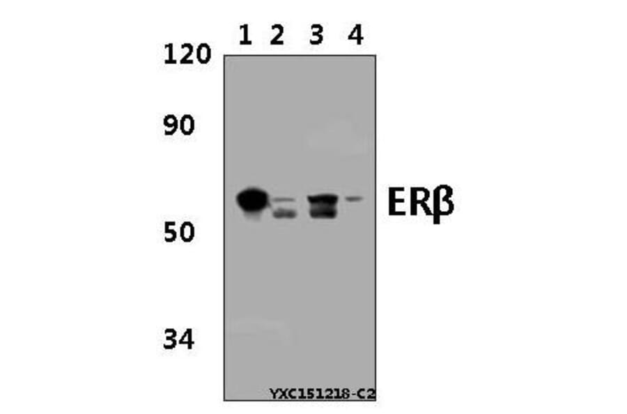 Anti-ERβ (E101) Antibody from Bioworld Technology (BS2429) - Antibodies.com