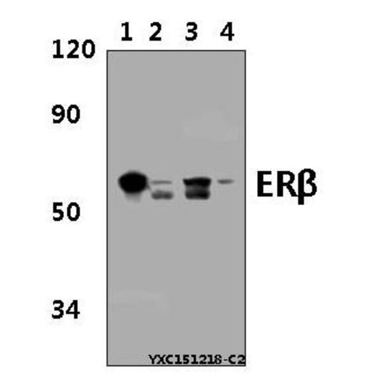 Anti-ERβ (E101) Antibody from Bioworld Technology (BS2429) - Antibodies.com