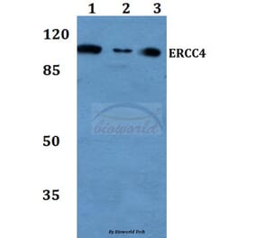 Anti-ERCC4 (A822) Antibody from Bioworld Technology (BS2430) - Antibodies.com