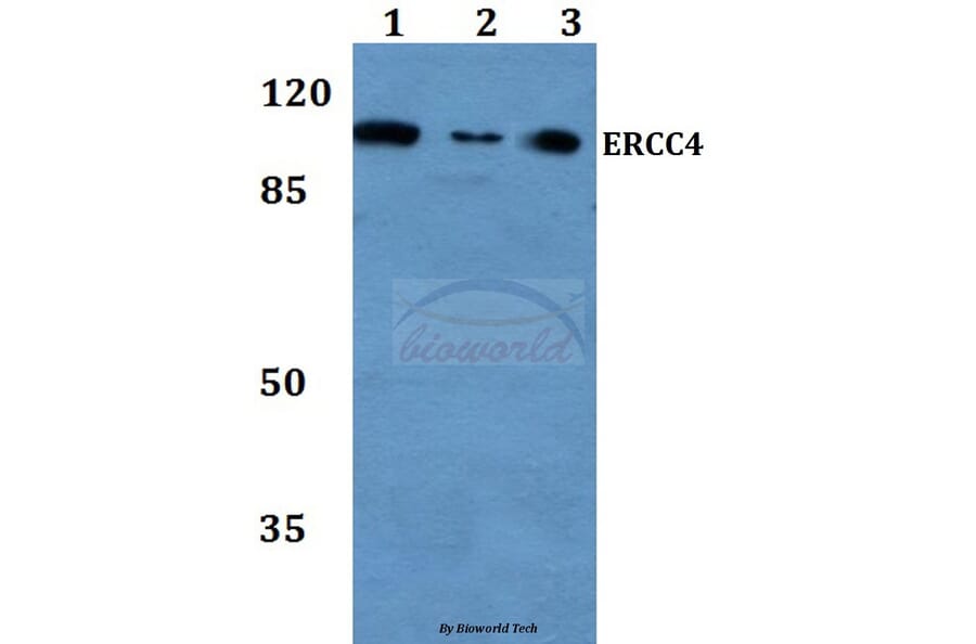 Anti-ERCC4 (A822) Antibody from Bioworld Technology (BS2430) - Antibodies.com