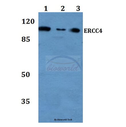 Anti-ERCC4 (A822) Antibody from Bioworld Technology (BS2430) - Antibodies.com