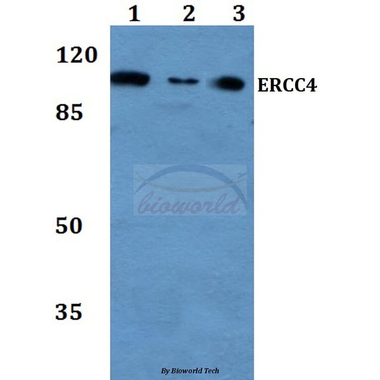 Anti-ERCC4 (A822) Antibody from Bioworld Technology (BS2430) - Antibodies.com