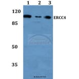 Anti-ERCC4 (A822) Antibody from Bioworld Technology (BS2430) - Antibodies.com