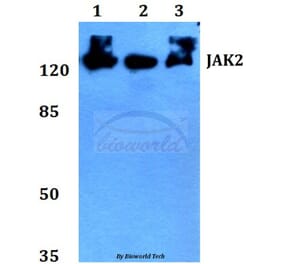 Anti-JAK2 (R564) Antibody from Bioworld Technology (BS2432) - Antibodies.com