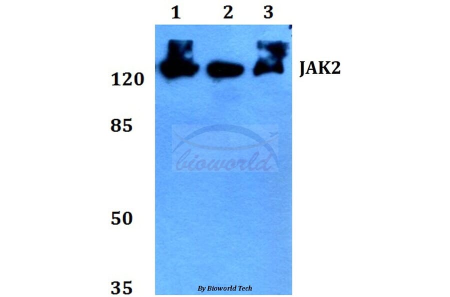 Anti-JAK2 (R564) Antibody from Bioworld Technology (BS2432) - Antibodies.com