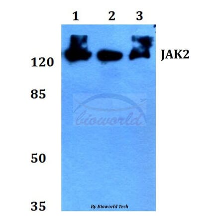 Anti-JAK2 (R564) Antibody from Bioworld Technology (BS2432) - Antibodies.com
