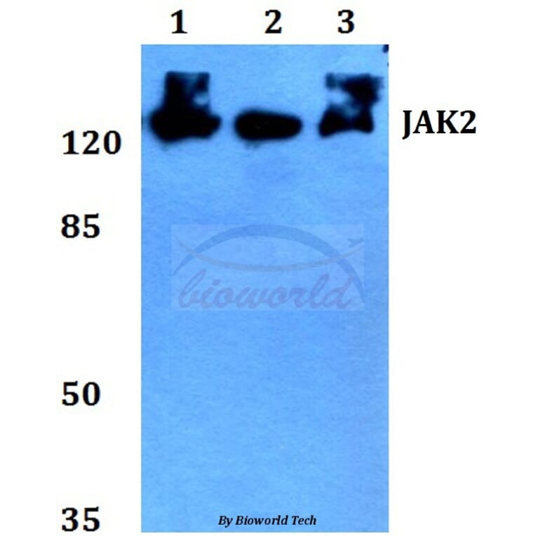 Anti-JAK2 (R564) Antibody from Bioworld Technology (BS2432) - Antibodies.com