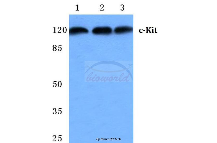 Anti-c-Kit (E930) Antibody from Bioworld Technology (BS2433) - Antibodies.com
