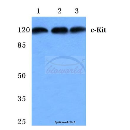Anti-c-Kit (E930) Antibody from Bioworld Technology (BS2433) - Antibodies.com